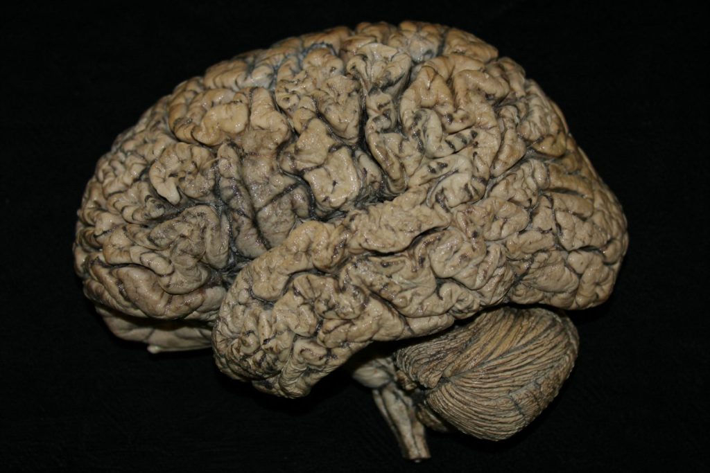 Representación de un cerebro deshidratado, ilustración conceptual sobre fondo blanco